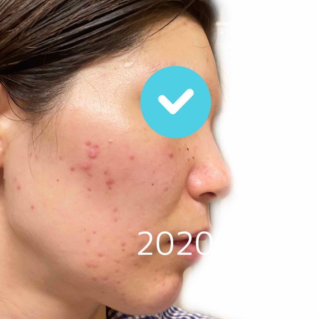 EclatCharme(エクラシャルム)/FABIUS/オールインワン化粧品を使ったクチコミ(4枚目)