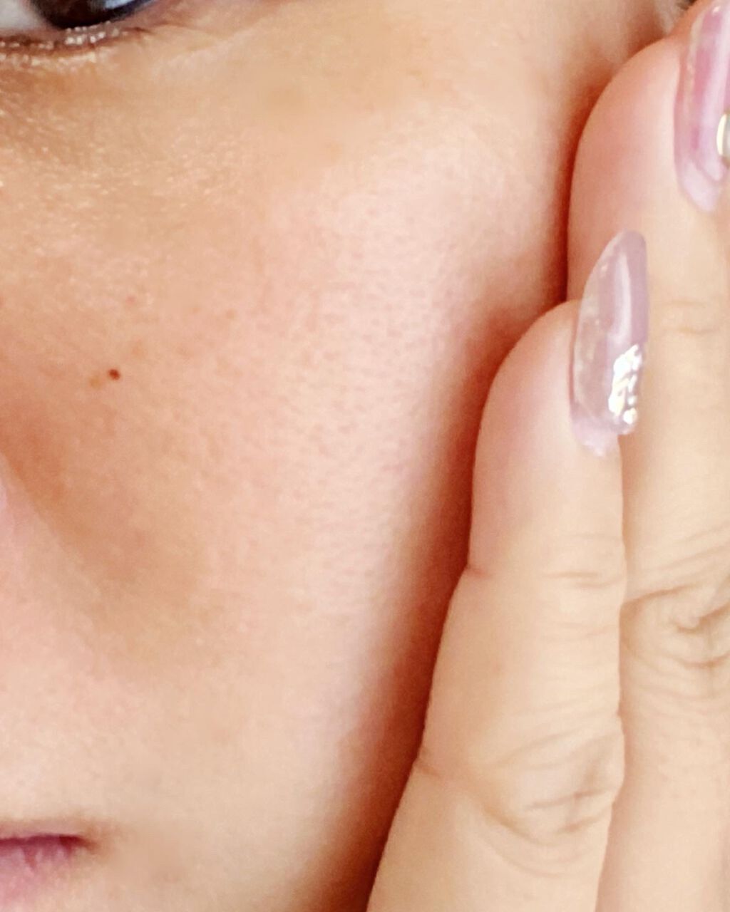 ヒト幹細胞培養エキス原液 LP/fracora/美容液を使ったクチコミ(5枚目)