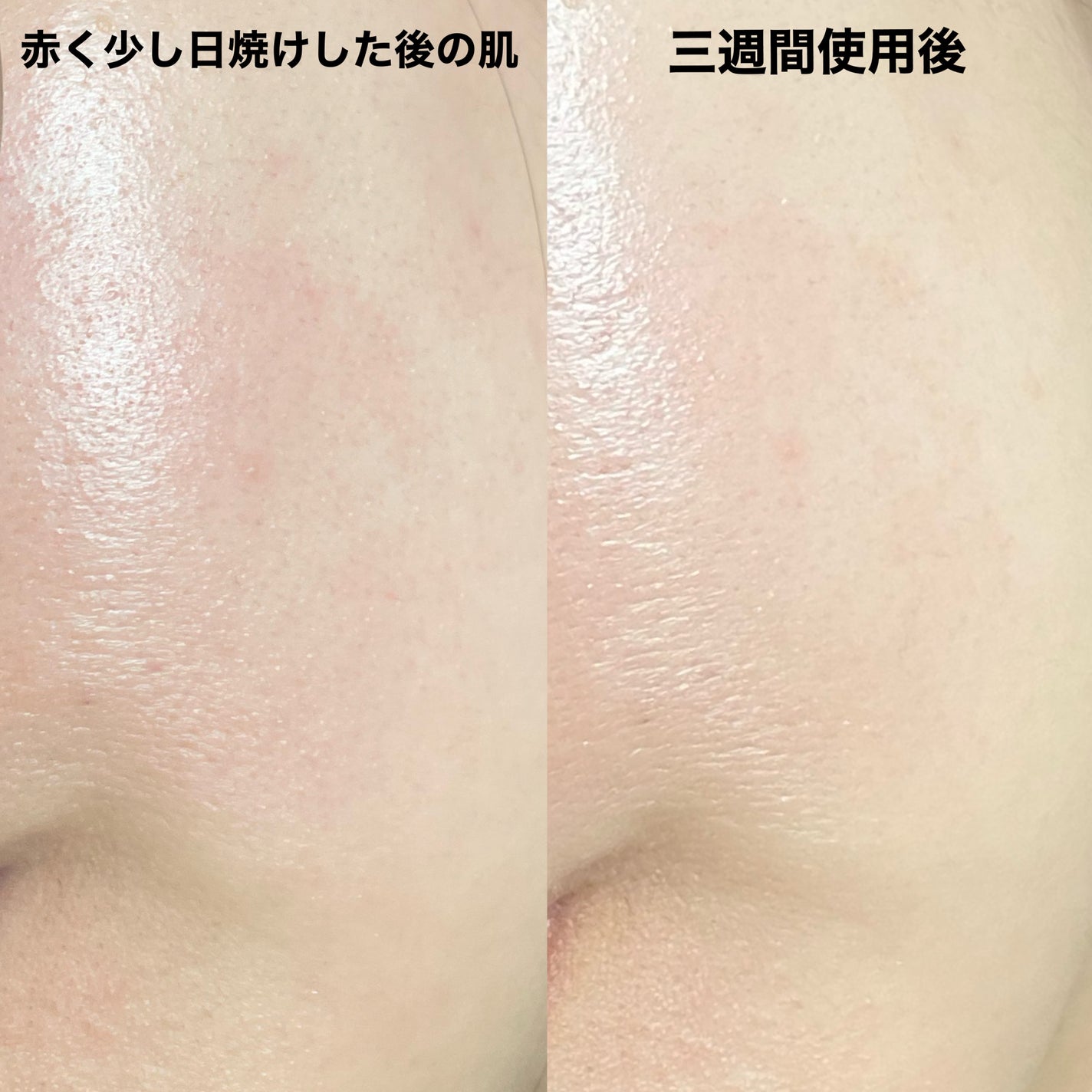 バイオ コンディショニング エッセンス/IOPE/ブースター・導入液を使ったクチコミ(3枚目)