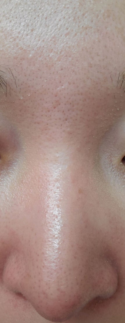 極潤 ヒアルロン液(旧)/肌ラボ/化粧水を使ったクチコミ(4枚目)