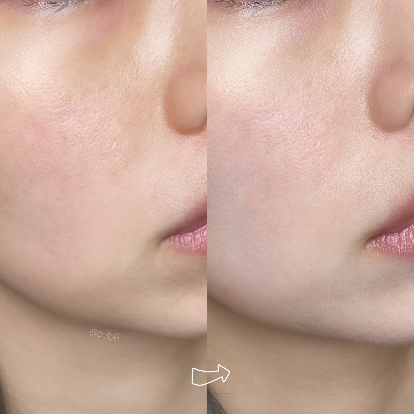 バリアダームマイルドサンクッション/SKIN&LAB/クッションファンデーションを使ったクチコミ(3枚目)