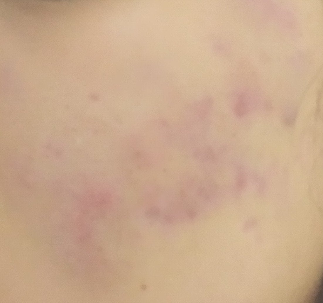 あみ on LIPS 「今日はいつものスキンケアにプラスしてパックもしてみました!ci..」(2枚目)