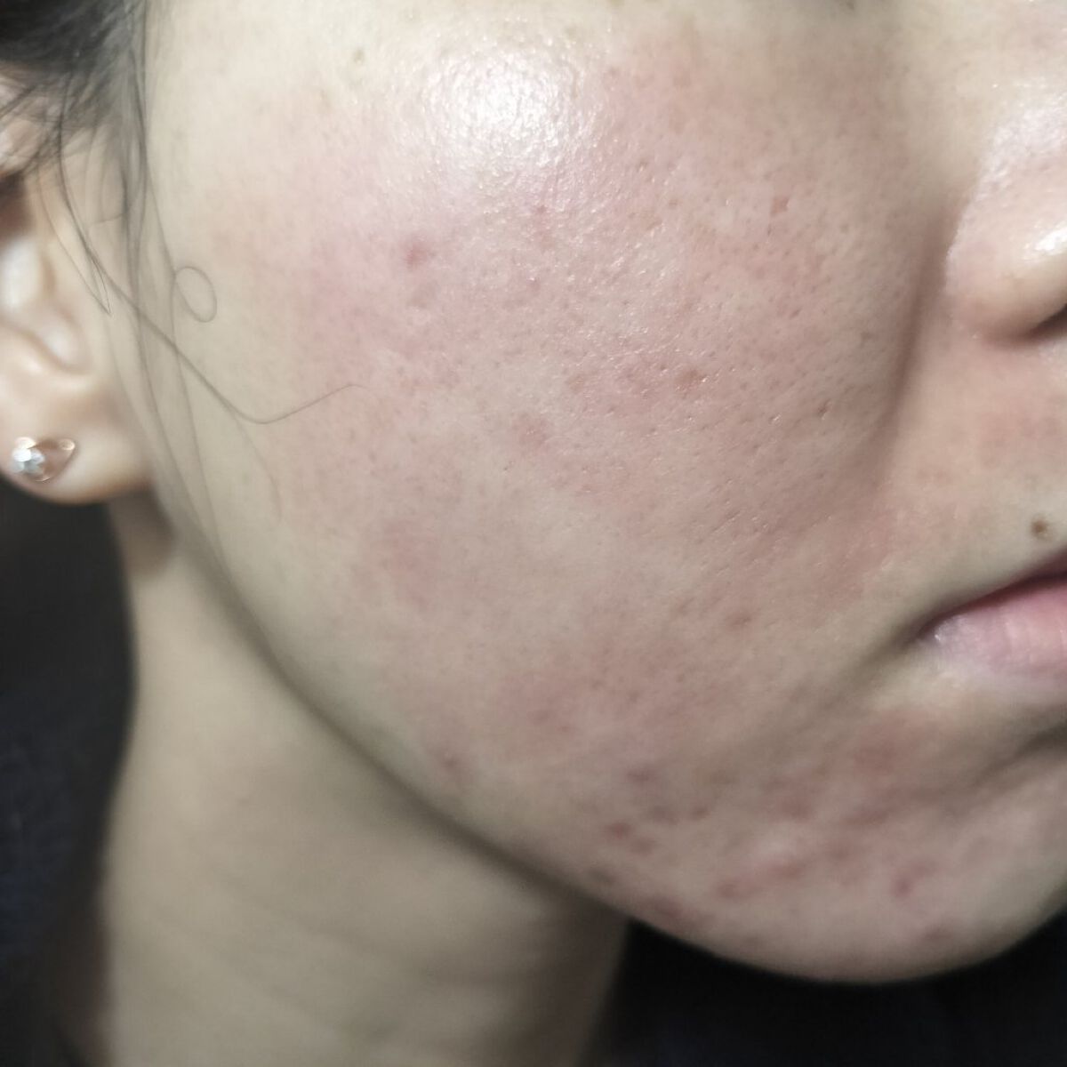 パイオネックス/セイリン/その他を使ったクチコミ（1枚目）