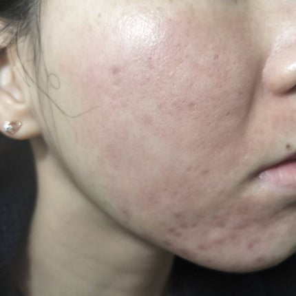 パイオネックス/セイリン/その他を使ったクチコミ(1枚目)