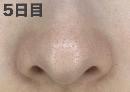 ビオレ おうちdeエステ メイク落とし マッサージブラックジェル プラス/ビオレ/クレンジングジェルを使ったクチコミ(2枚目)