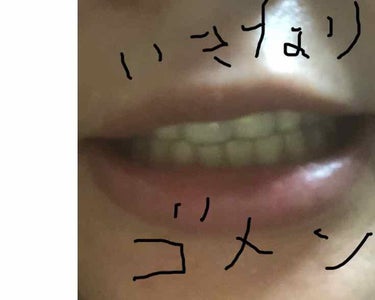 ヴィンテージガール on LIPS 「今日は歯の健康でもひとつ。グロい写真でごめんなさい。自分では呑..」（1枚目）