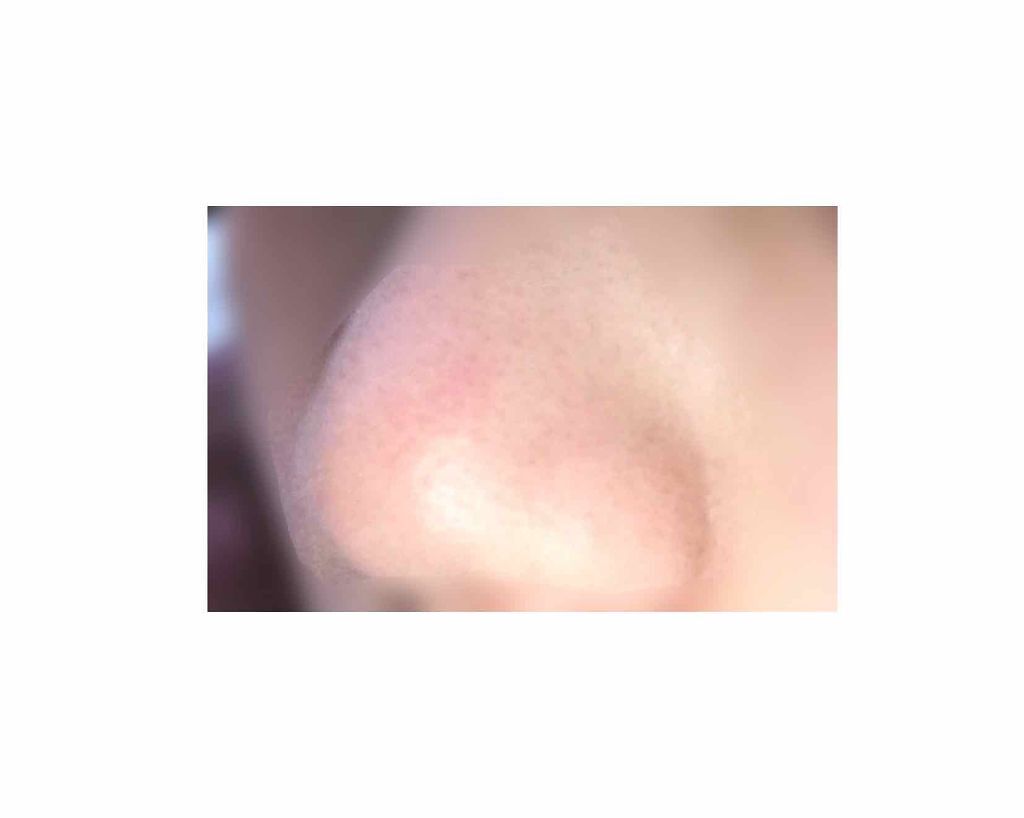 ボタニカル クリアローション シトラスハーブの香り/明色/化粧水を使ったクチコミ（2枚目）