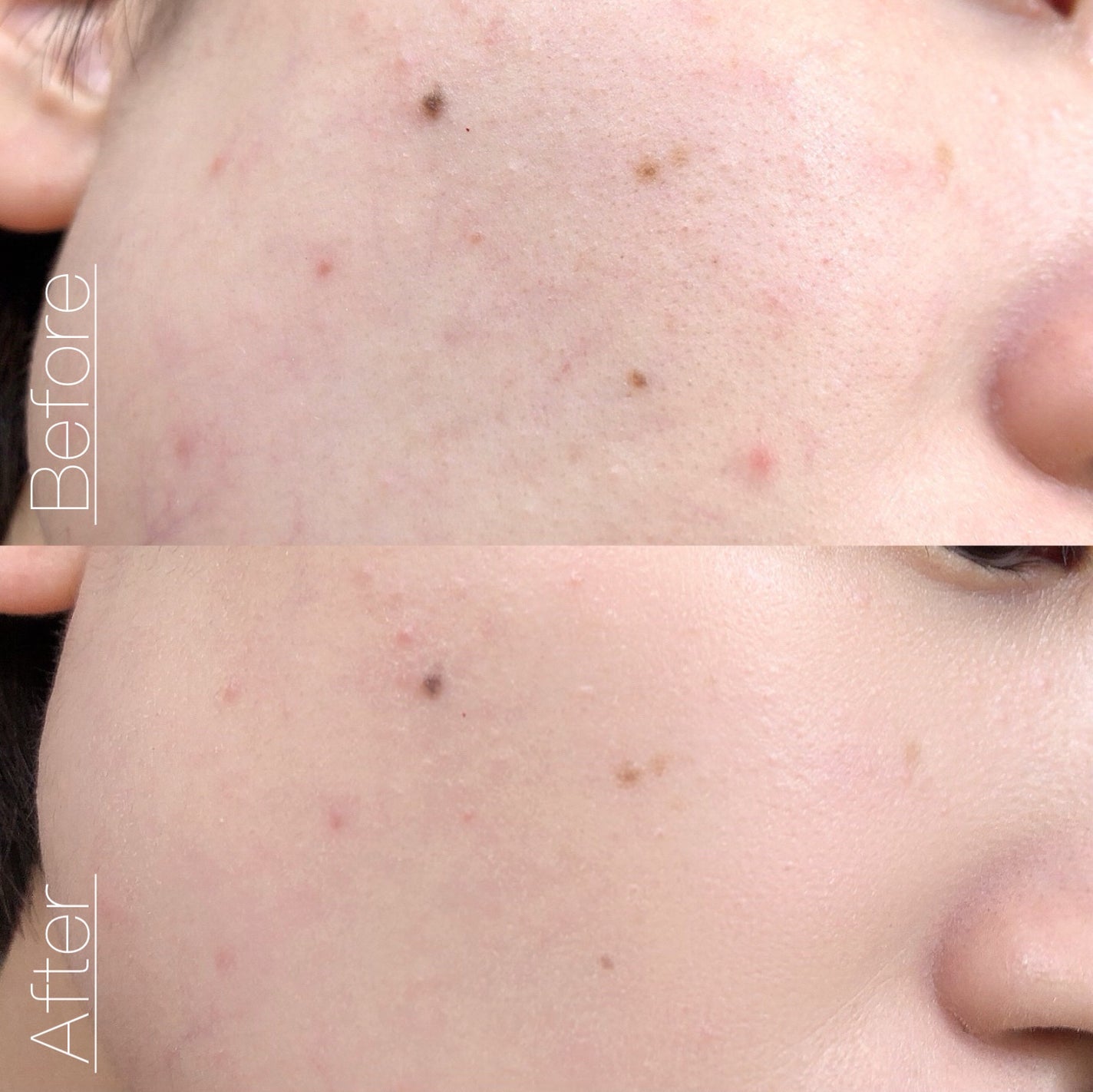 TOPARDS 1day/TOPARDS/ワンデー(1DAY)カラコンを使ったクチコミ(4枚目)