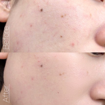 TOPARDS 1day/TOPARDS/ワンデー(1DAY)カラコンを使ったクチコミ(4枚目)