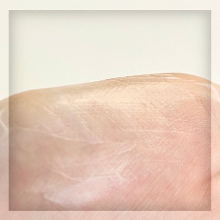 A.Cクリーム プレミアム/LEPOREM/フェイスクリームを使ったクチコミ(5枚目)