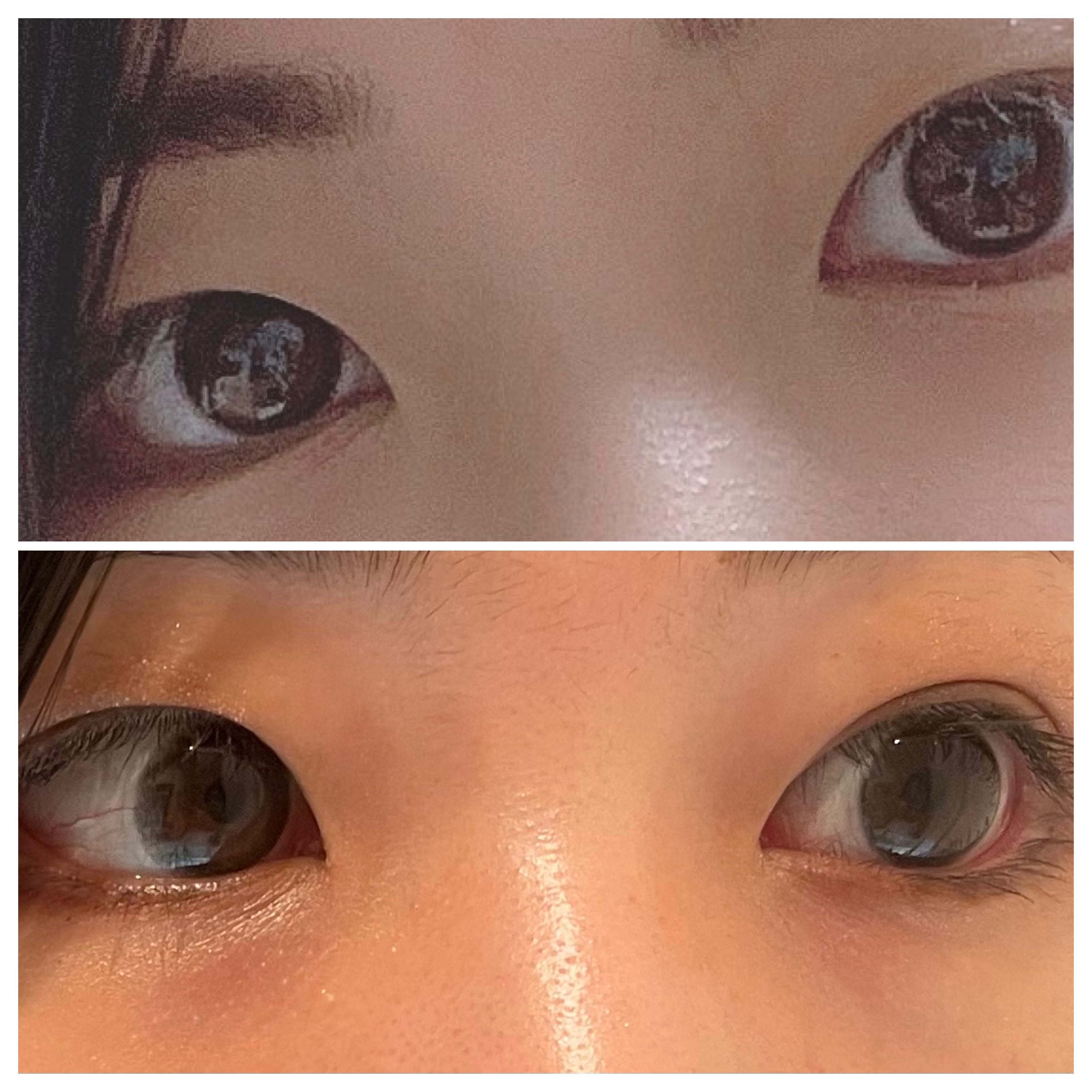 エバーカラーワンデーミリモア はじらいベイビー/エバーカラー/ワンデー（１DAY）カラコンを使ったクチコミ（2枚目）