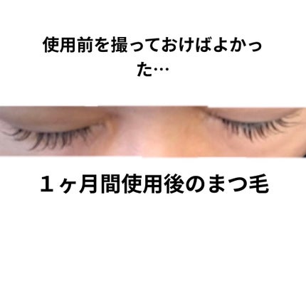 アイラッシュセラム/PHOEBE BEAUTY UP/まつげ美容液を使ったクチコミ(3枚目)