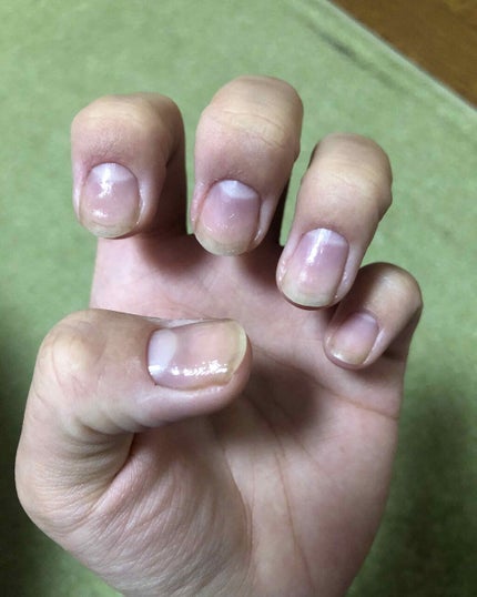 ネイルベッドオイル/アンドネイル/ネイルオイル・トリートメントを使ったクチコミ(1枚目)