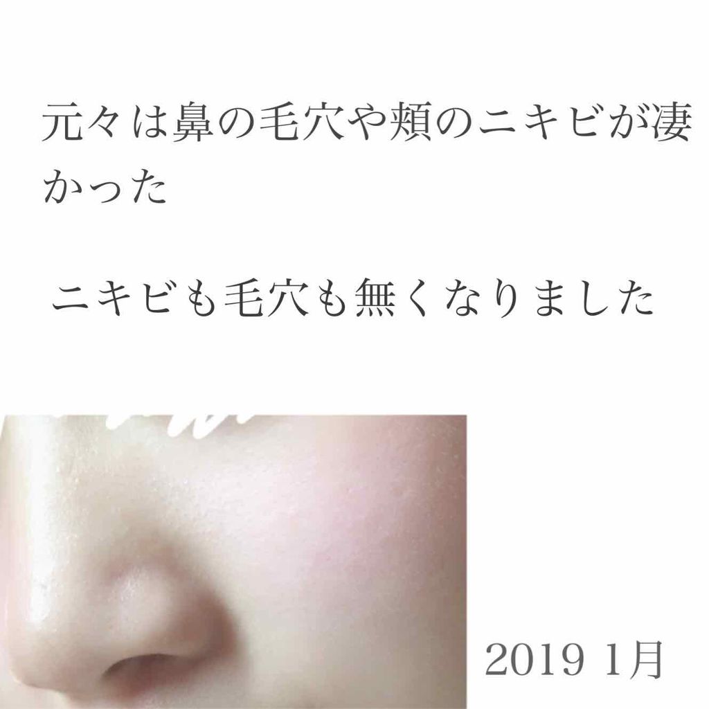 ハトムギ化粧水(ナチュリエ スキンコンディショナー R )/ナチュリエ/化粧水を使ったクチコミ（2枚目）