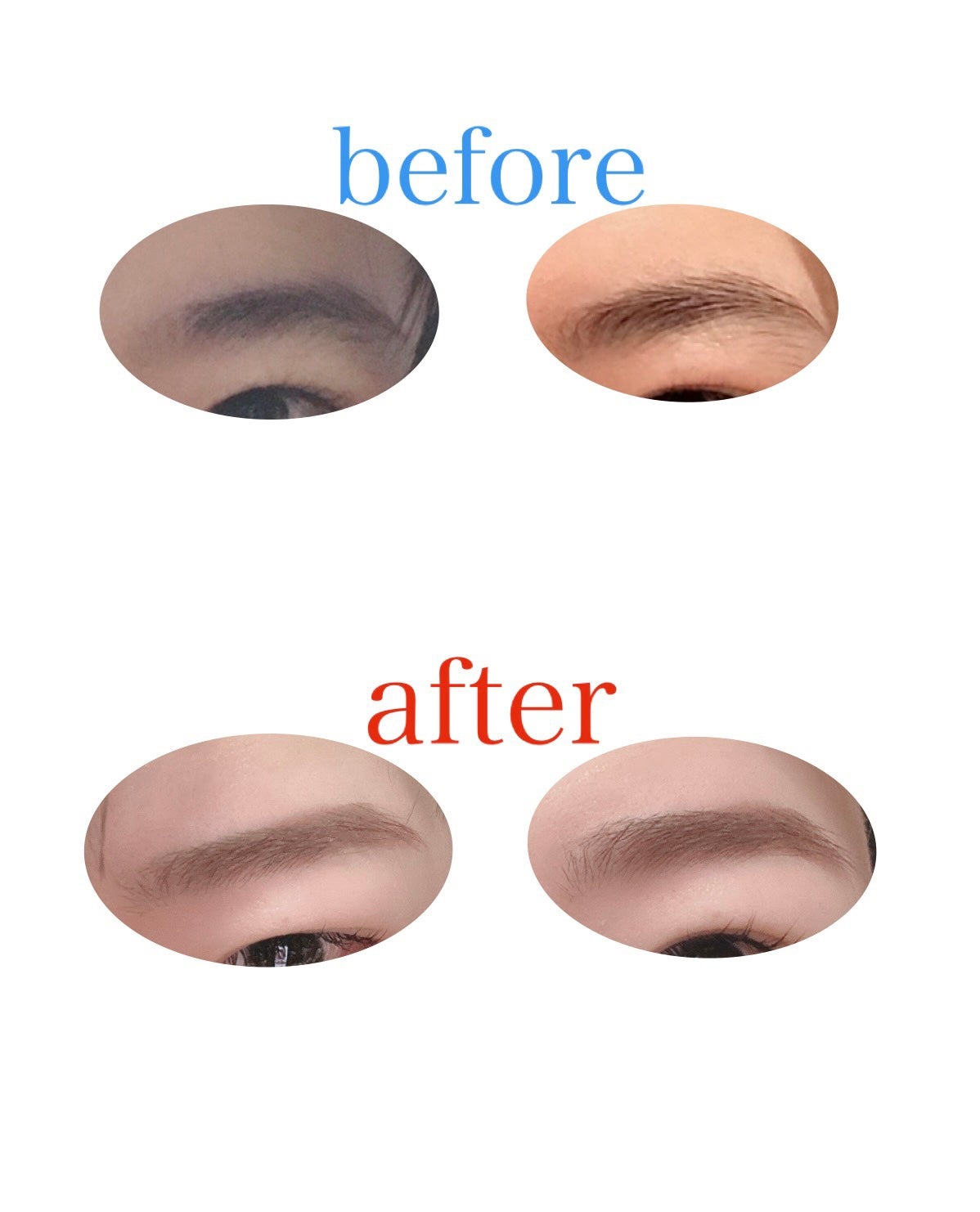 HusiQ.K on LIPS 「恐るべし脱毛waxの力🥹一気に垢抜けできちゃう!顔の比率測って..」(1枚目)