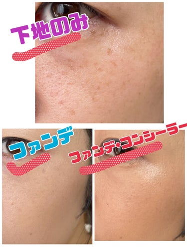 スポッツカバー ファウンデイション （ベースカラー）S300/SHISEIDO/クリームコンシーラーを使ったクチコミ（3枚目）