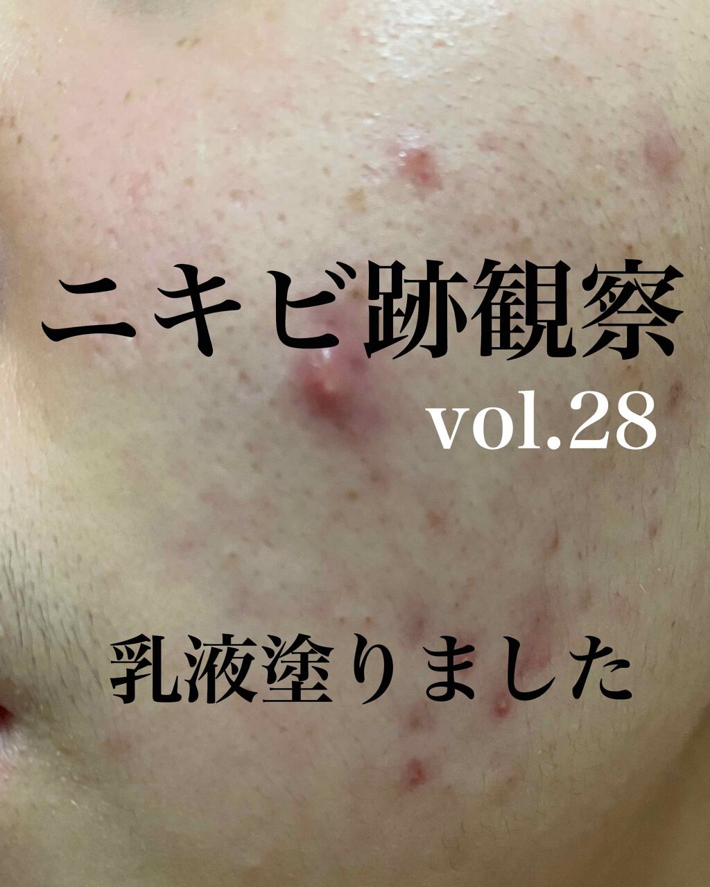 Cセラム/b.glen/美容液を使ったクチコミ（1枚目）