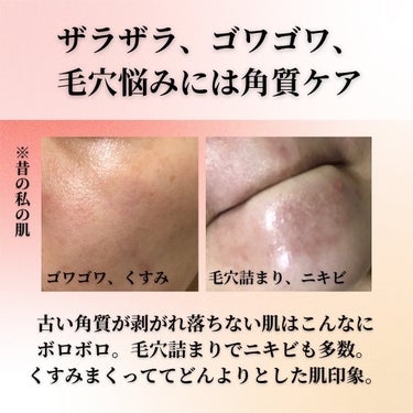 マンデリック インテンシブ 18%セラム 15ml/DR.WU/美容液を使ったクチコミ（3枚目）