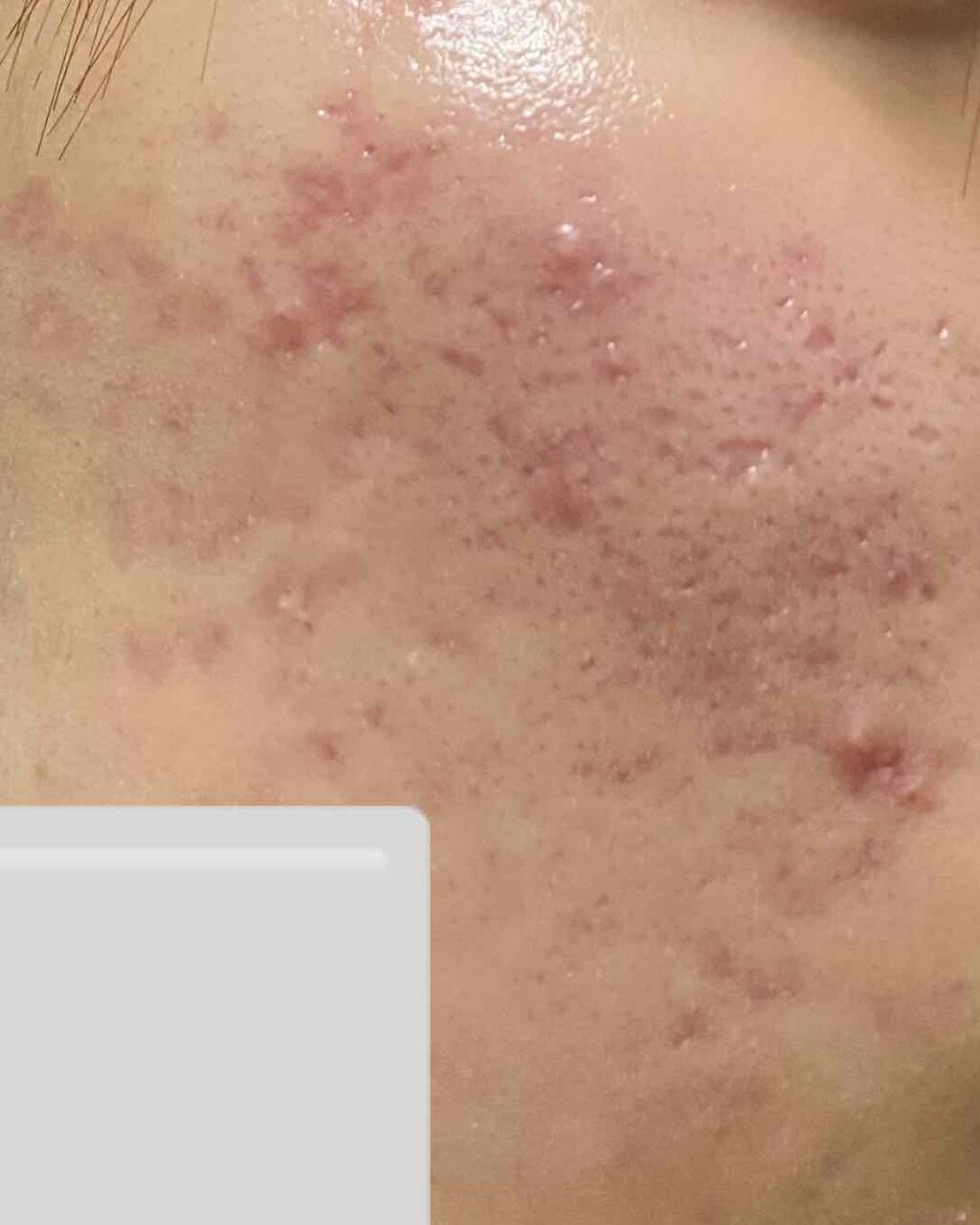 潤浸保湿 乳液/キュレル/乳液を使ったクチコミ(2枚目)