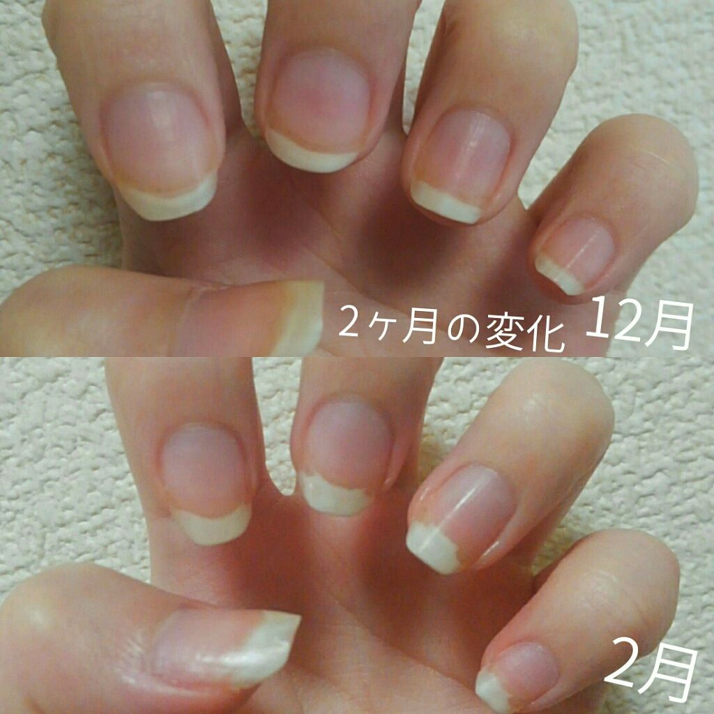 甘皮切りセット/DAISO/ネイル用品を使ったクチコミ（3枚目）