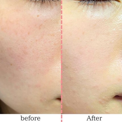 エッセンス スキングロウ ファンデーション/SHISEIDO/リキッドファンデーションを使ったクチコミ(3枚目)