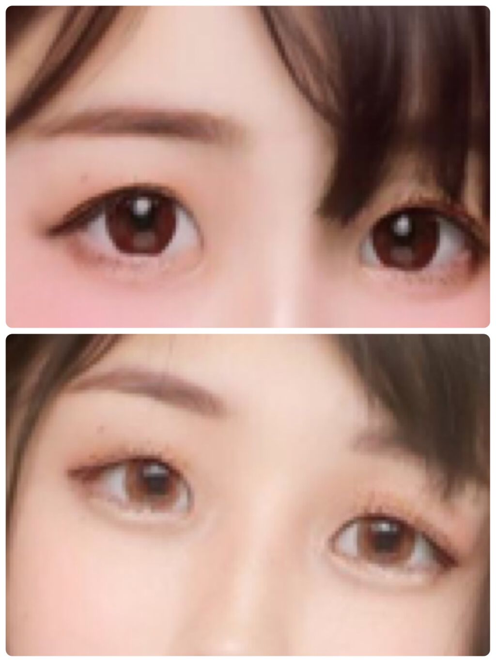 kono on LIPS 「ちょっと時は遡りますが1月中旬頃実はプチ整形をTCBさんで行っ..」(1枚目)