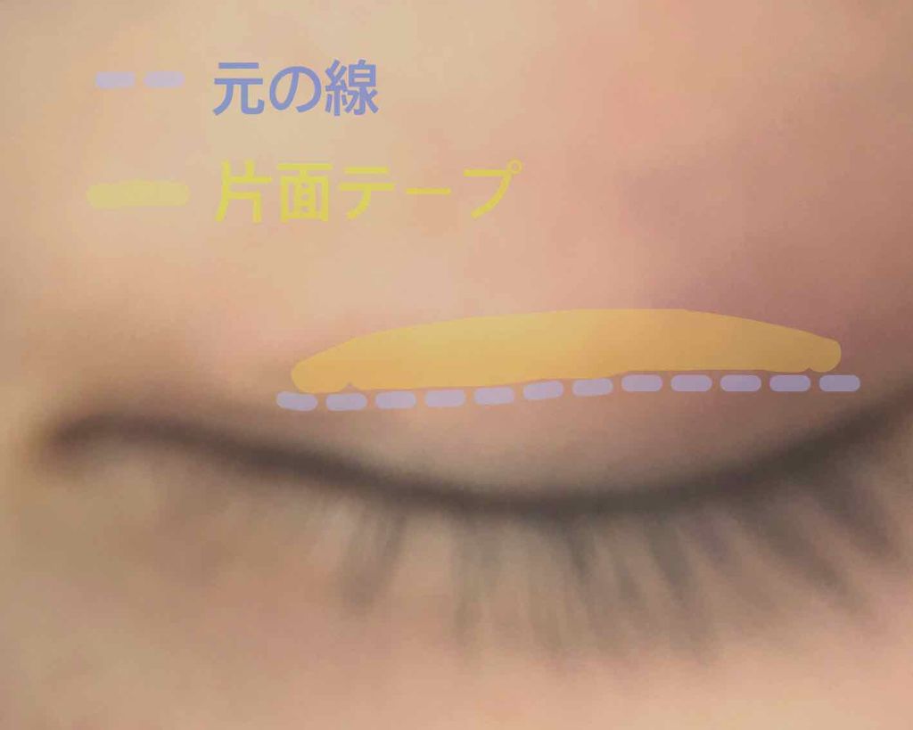 アイテープ 埋没式両面テープ/DAISO/二重まぶた用アイテムを使ったクチコミ(3枚目)