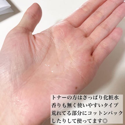 ドクダミ 77 スージングトナー/Anua/化粧水を使ったクチコミ(3枚目)