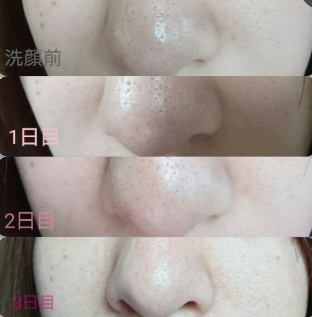 ドットウォッシー洗顔石鹸(旧)/ペリカン石鹸/洗顔石鹸を使ったクチコミ（2枚目）