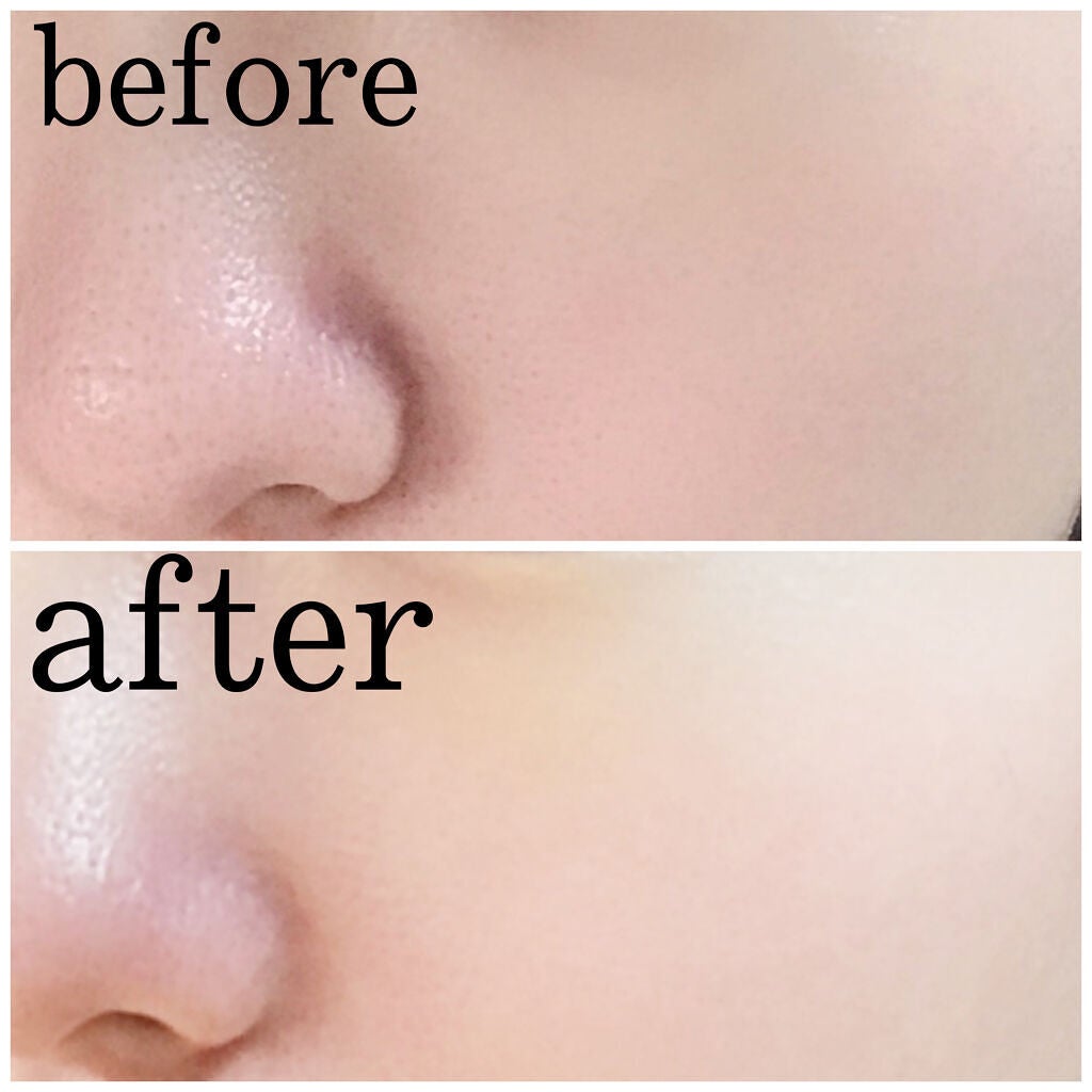 REプラセンタ美容液/RE(アール・イー)/美容液を使ったクチコミ(5枚目)