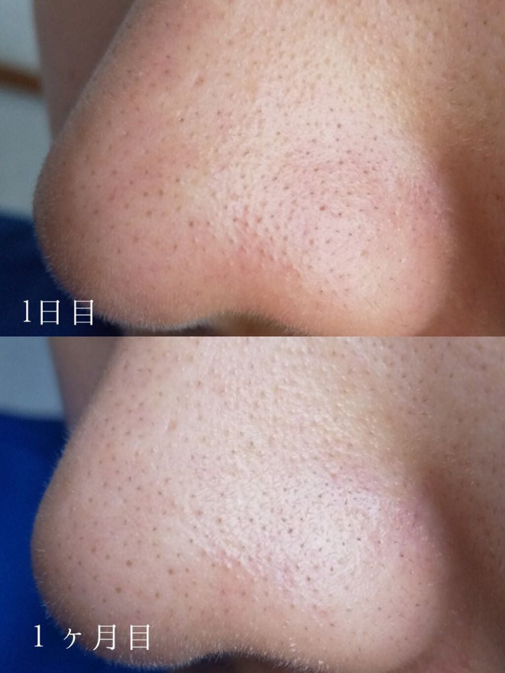 スキンクリア クレンズ オイル アロマタイプ/アテニア/オイルクレンジングを使ったクチコミ(4枚目)