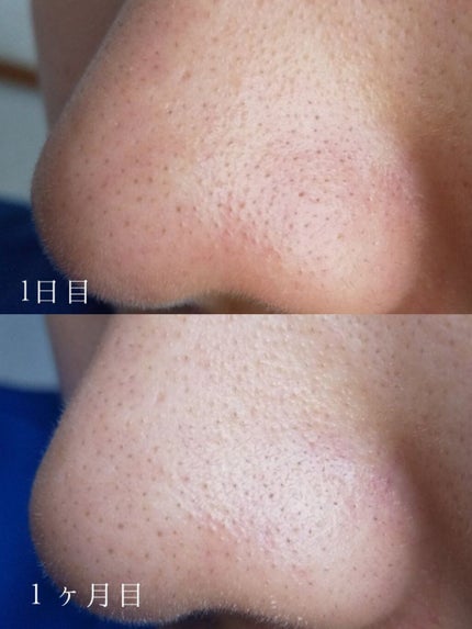 スキンクリア クレンズ オイル アロマタイプ/アテニア/オイルクレンジングを使ったクチコミ(4枚目)