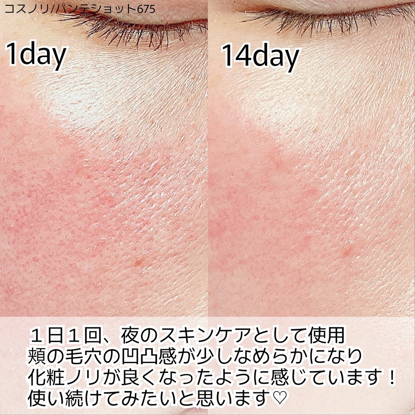 パンテショット675/COSNORI/美容液を使ったクチコミ(4枚目)
