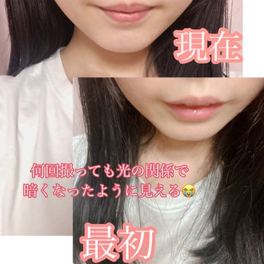 敏感肌用薬用美白美容液/無印良品/美容液を使ったクチコミ（2枚目）