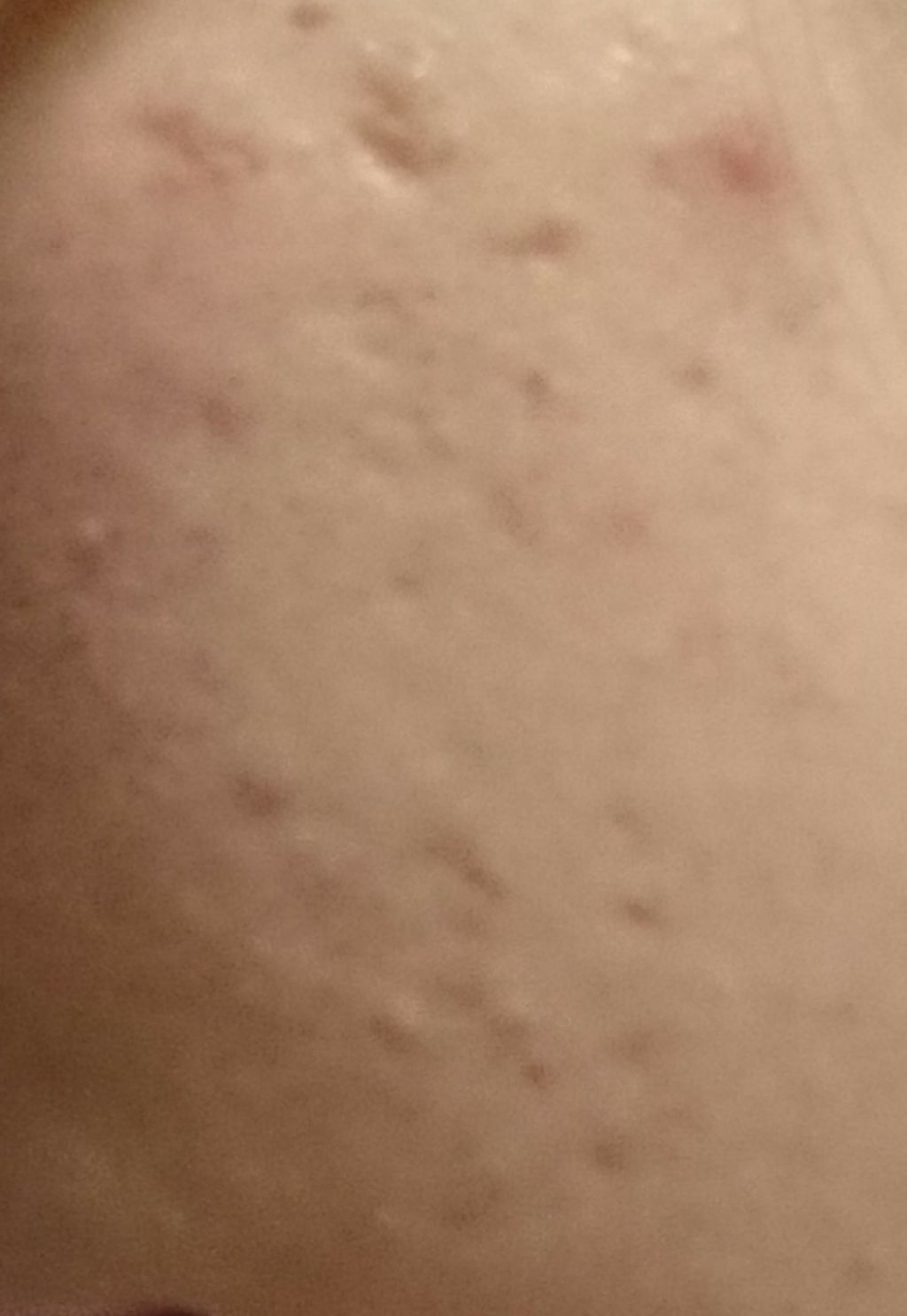 エクサージュホワイト ホワイトニング ピュア チャージャー/ALBION/美容液を使ったクチコミ（2枚目）