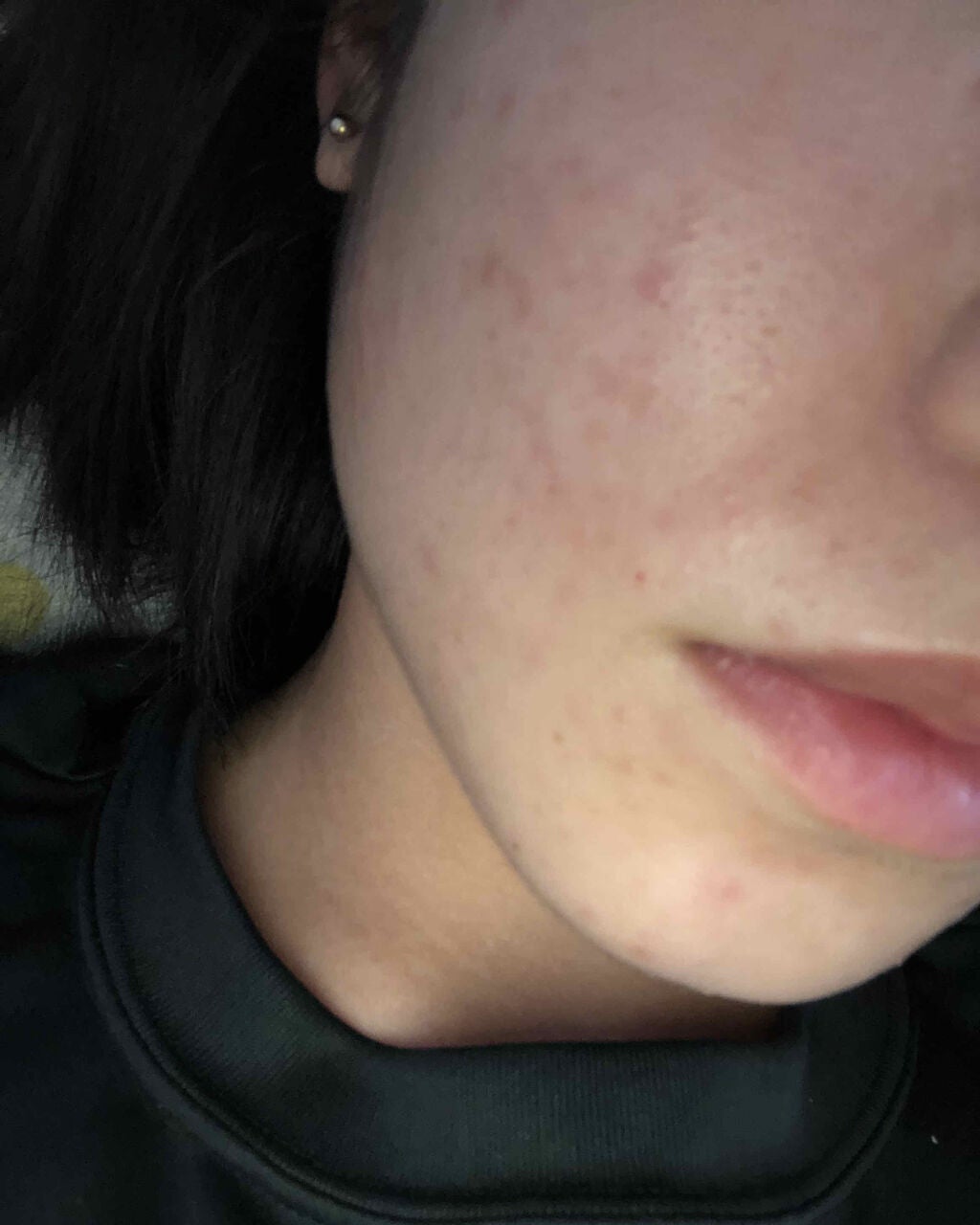 香織 on LIPS 「助けてください…高校3年生の香織(カオリ)です🌱𓂃𓈒𓏸オイリー..」(1枚目)