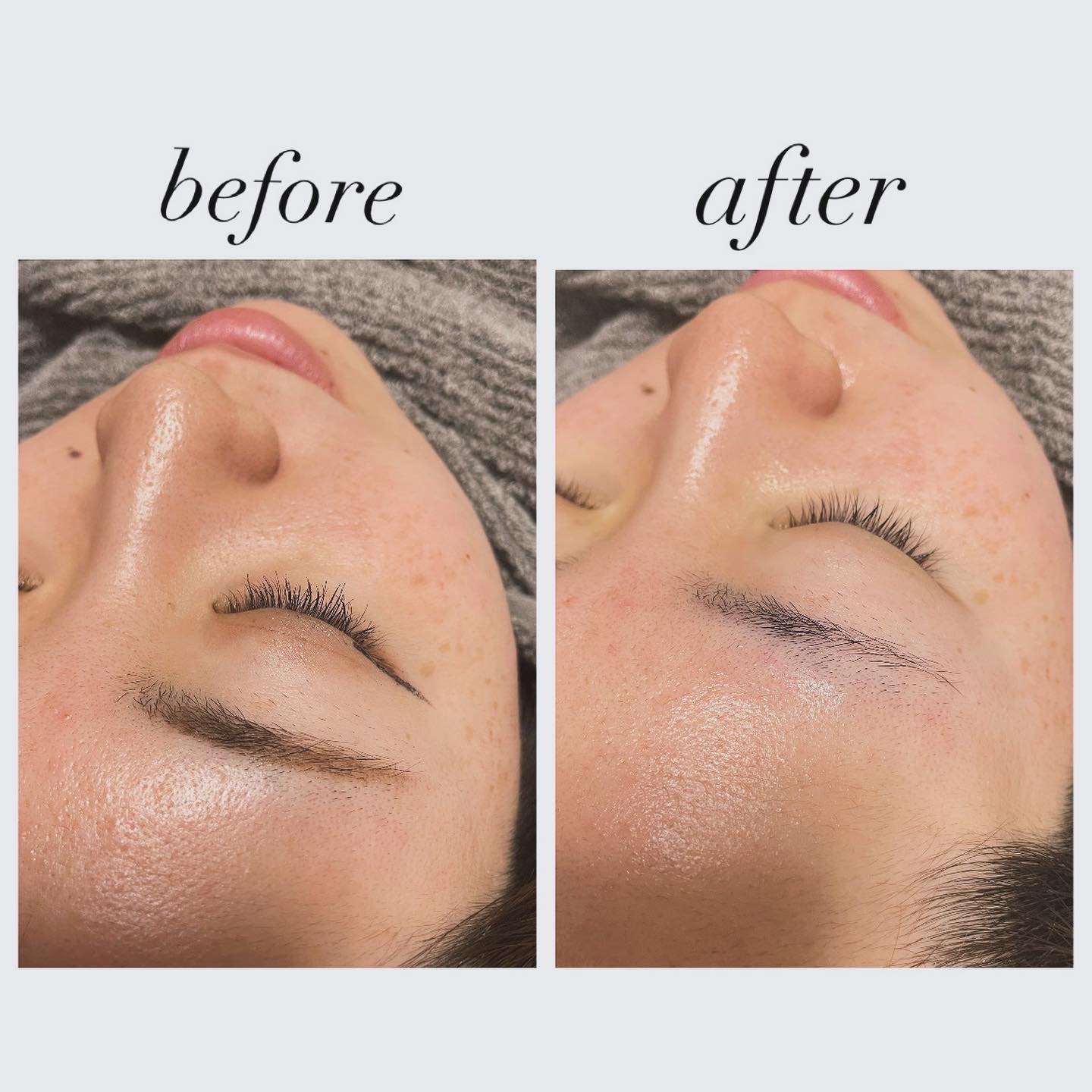 ミノン アミノモイスト モイストミルキィ クレンジング/ミノン/ミルククレンジングを使ったクチコミ（2枚目）