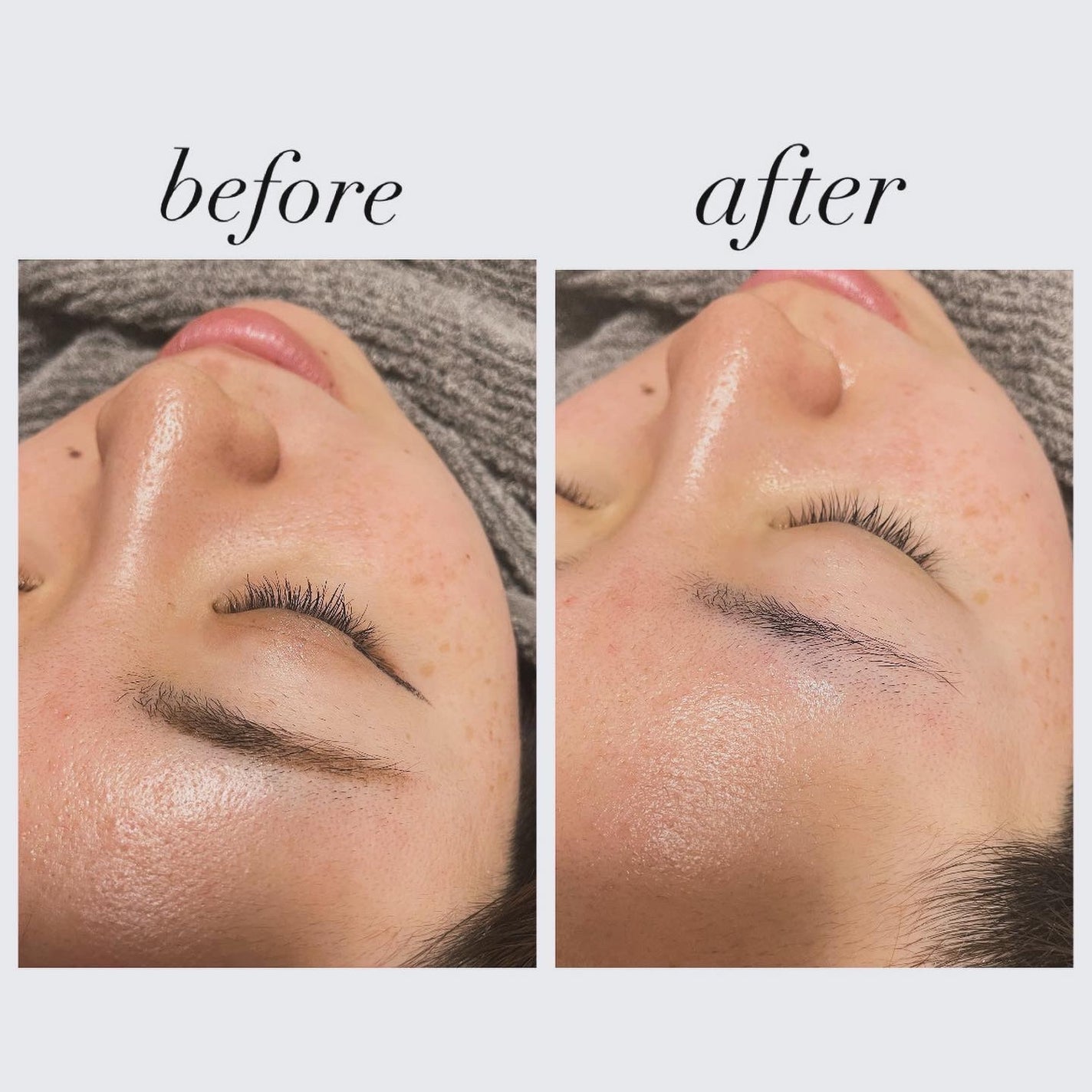 ミノン アミノモイスト モイストミルキィ クレンジング/ミノン/ミルククレンジングを使ったクチコミ(2枚目)