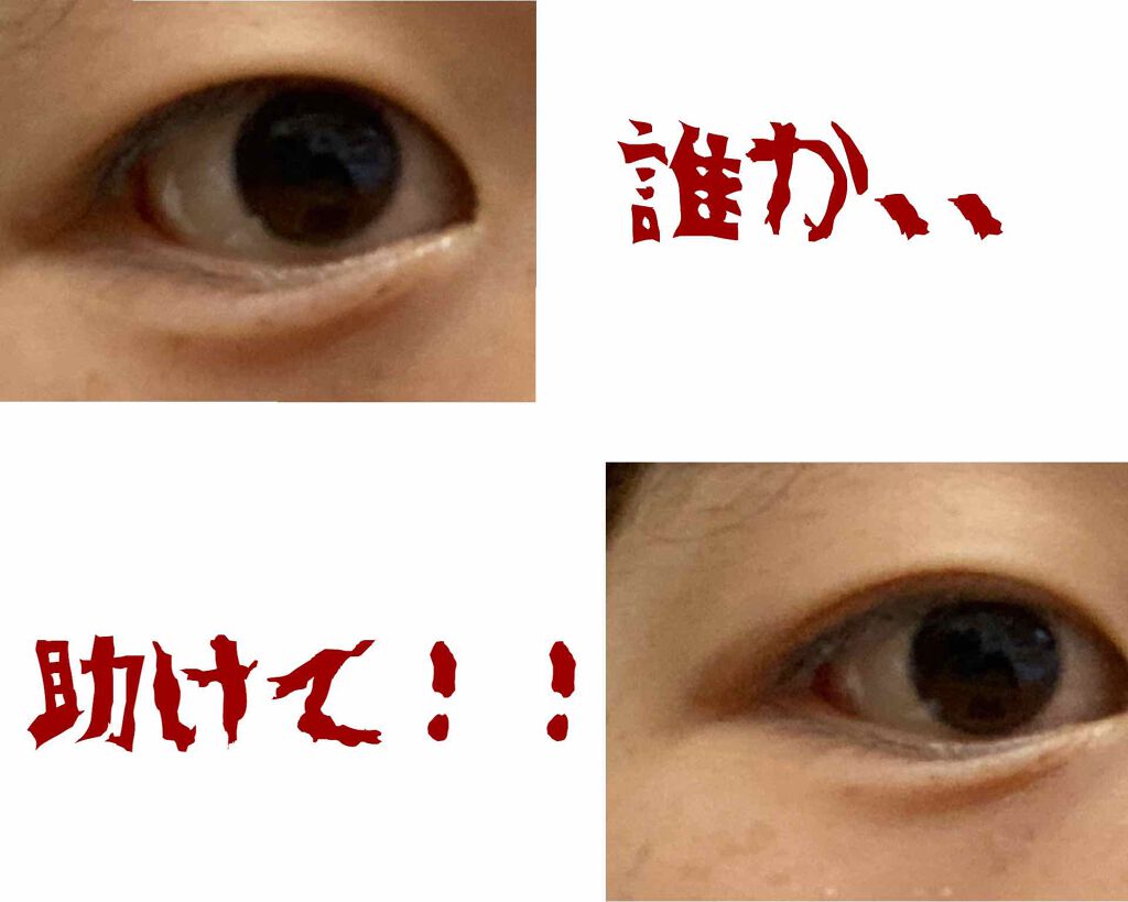 【旧品】オリシキ アイリッドスキンフィルム/D-UP/二重まぶた用アイテムを使ったクチコミ(1枚目)