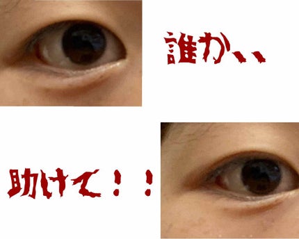 【旧品】オリシキ アイリッドスキンフィルム/D-UP/二重まぶた用アイテムを使ったクチコミ(1枚目)