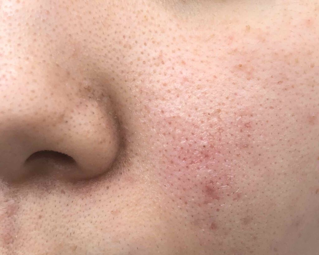 ボタニカル高保湿ジェル/NICE & QUICK/美容液を使ったクチコミ(1枚目)