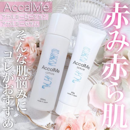 アカルミー化粧水/ワイズ/化粧水を使ったクチコミ(1枚目)