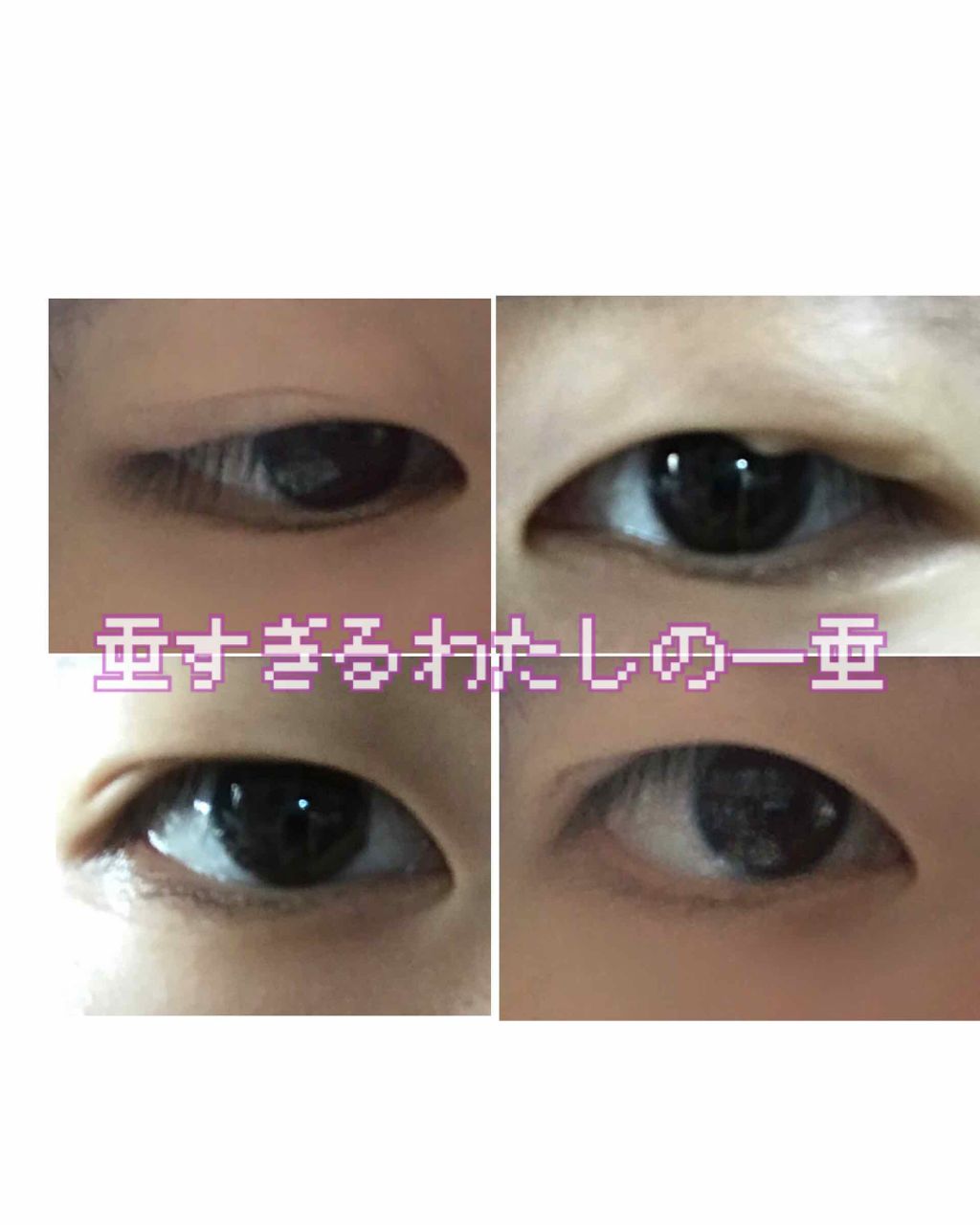 防水透明バン/DAISO/その他を使ったクチコミ(1枚目)