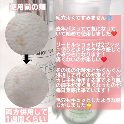 シカレチA エッセンス0.1/VT/美容液を使ったクチコミ(7枚目)