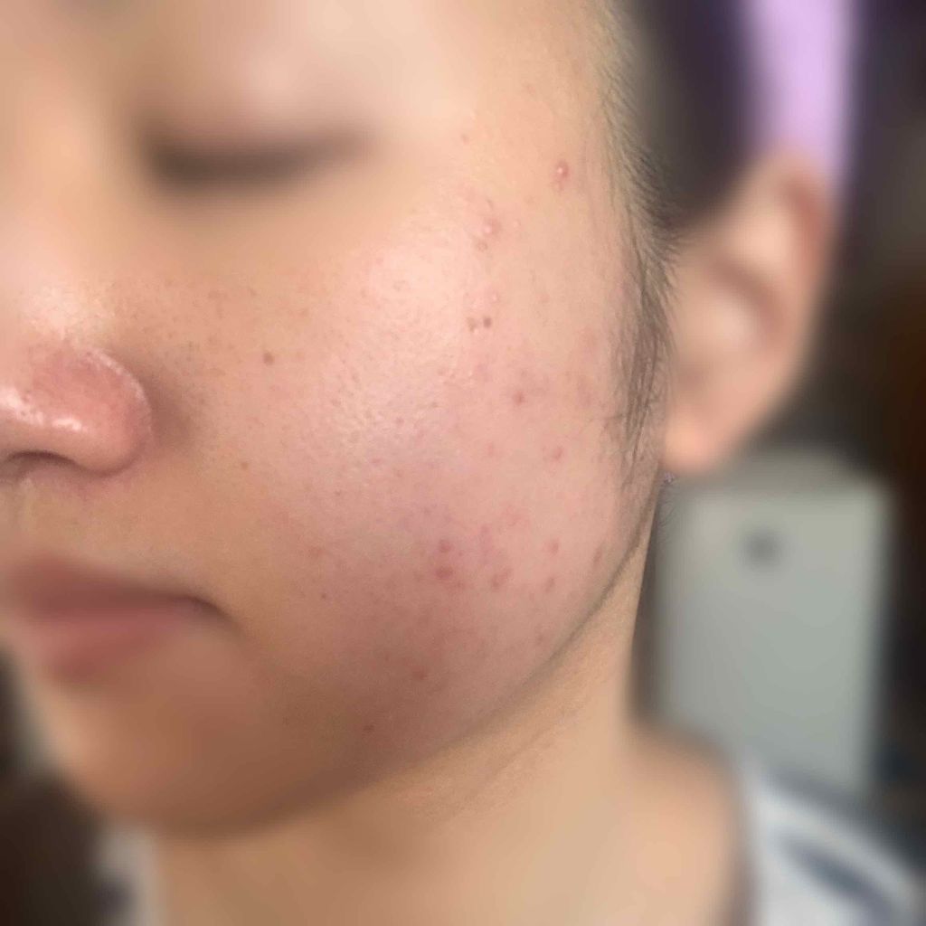 ハトムギ化粧水(ナチュリエ スキンコンディショナー R )/ナチュリエ/化粧水を使ったクチコミ(2枚目)