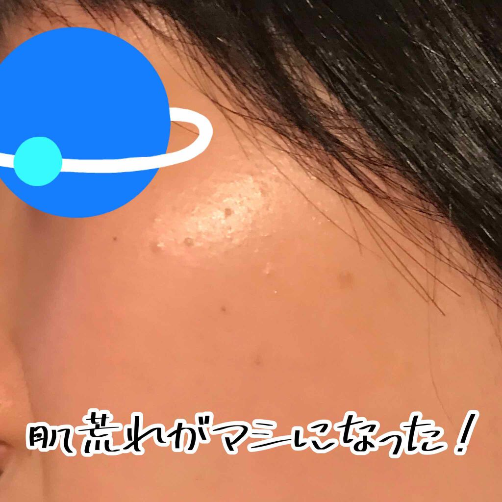 オードムーゲ 薬用ローション（ふきとり化粧水）/オードムーゲ/拭き取り化粧水を使ったクチコミ（2枚目）