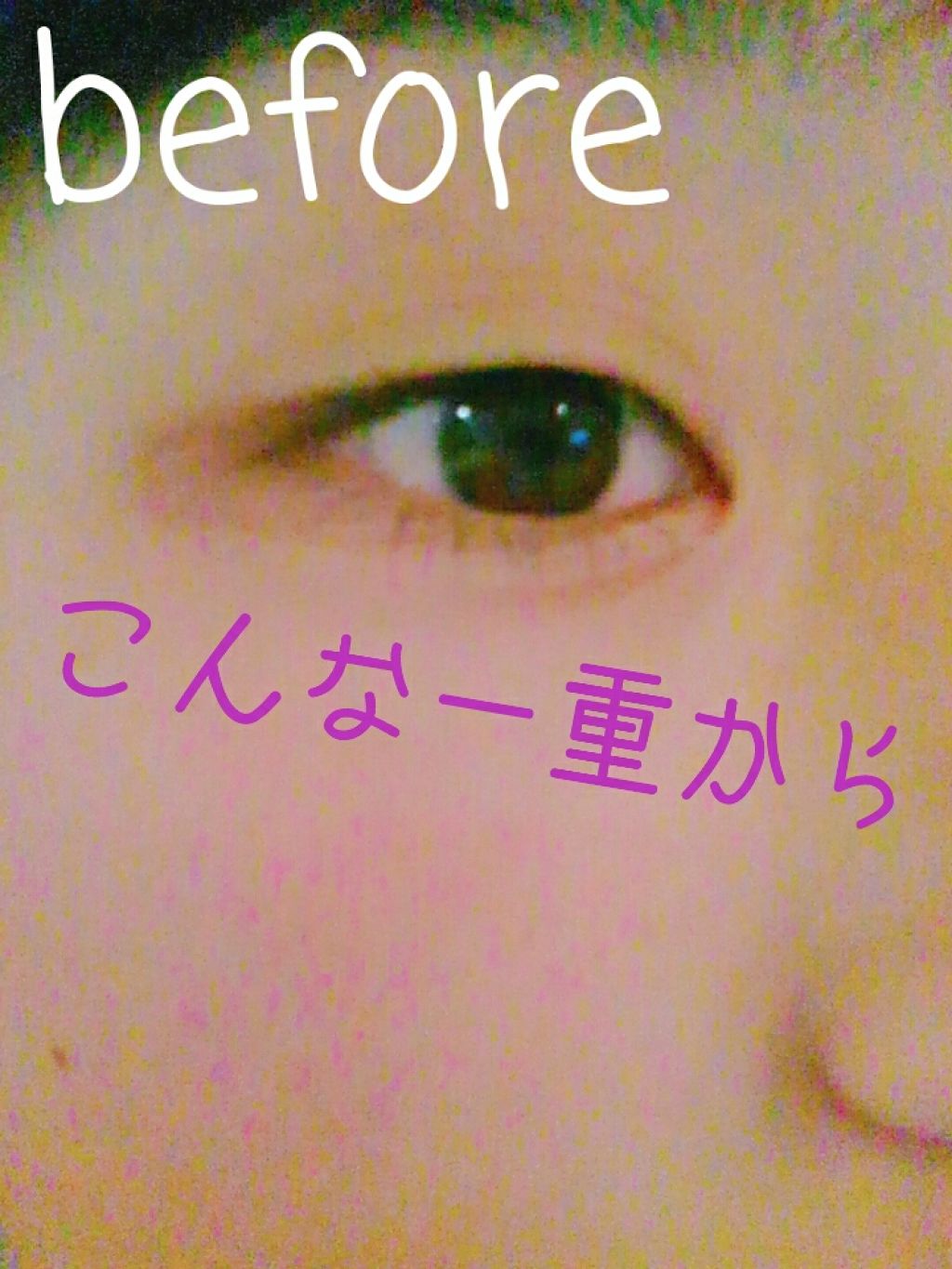 あお on LIPS 「一重→二重に!もともと色々やってて、ちょっとはクセがついてたけ..」(1枚目)