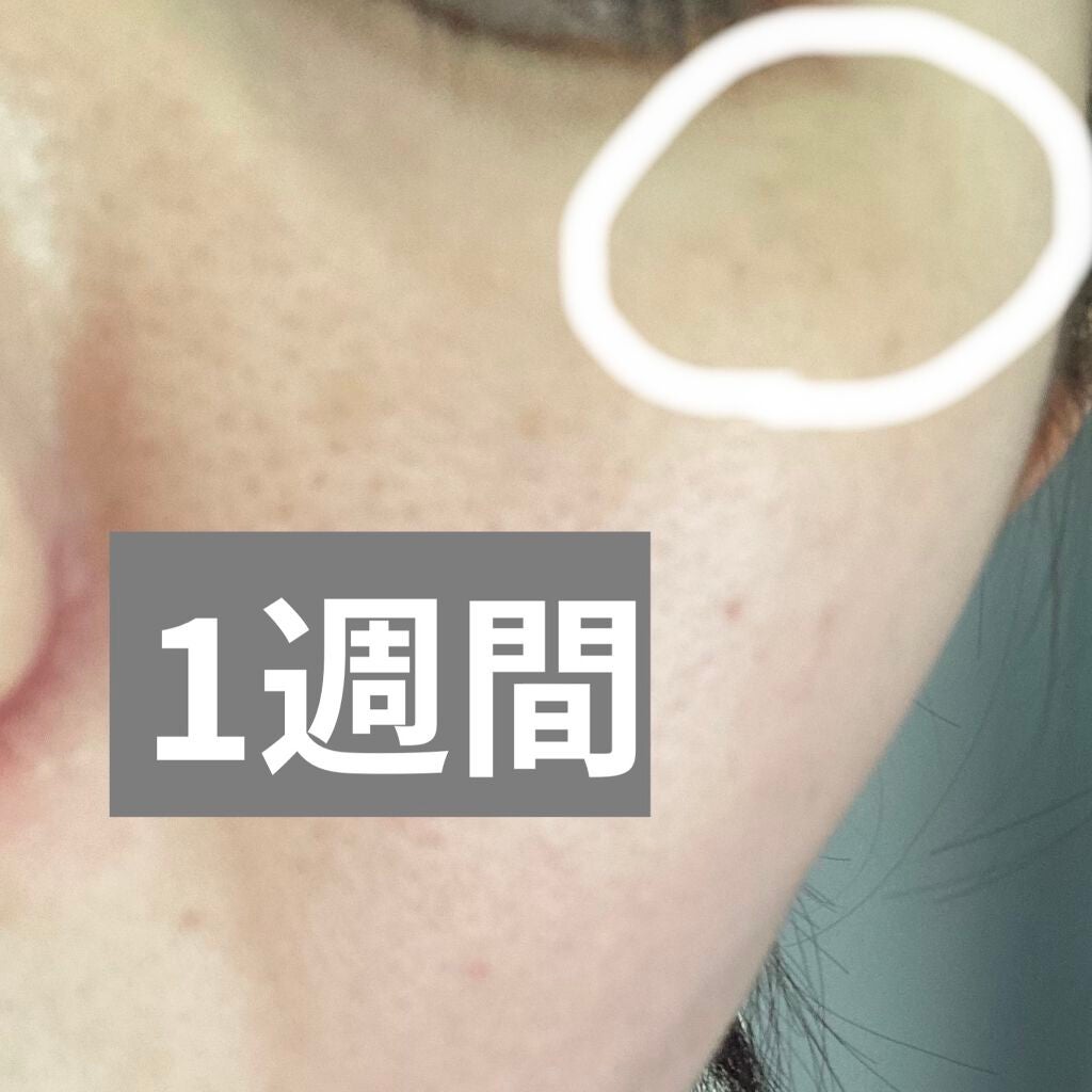 敏感肌用薬用美白美容液/無印良品/美容液を使ったクチコミ(3枚目)