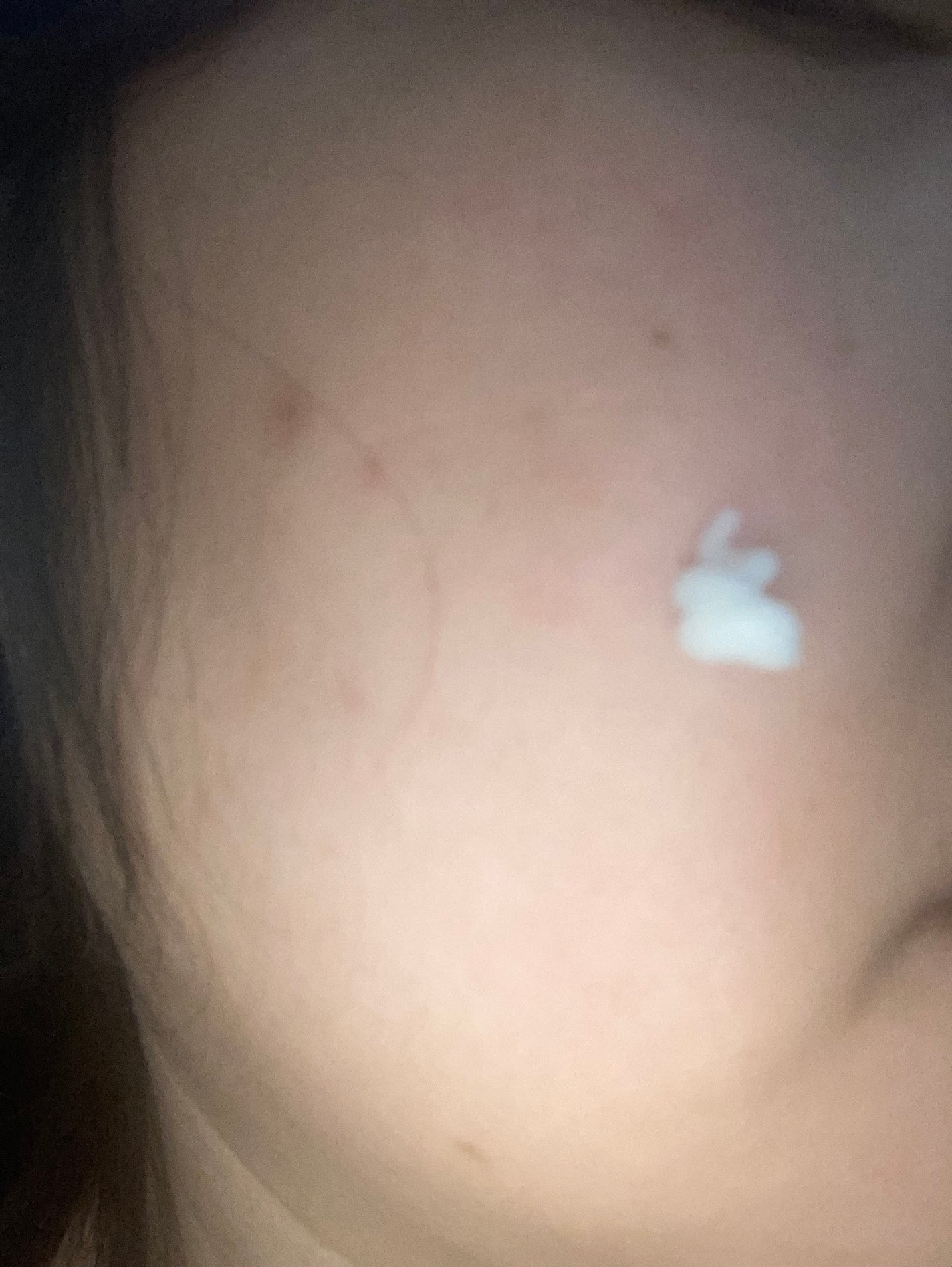 リードルショット700/VT/美容液を使ったクチコミ(3枚目)