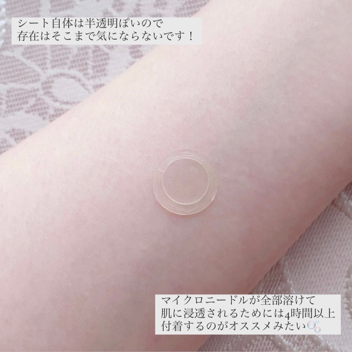 エーキュアショットスポットパッチ/obsero/にきびパッチを使ったクチコミ(5枚目)